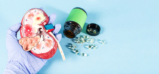 A person is holding a model of a kidney and a bottle of pills, vitamin D.