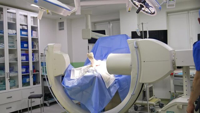 C-Arm machine producing high-resolution and high-contrast real-time images of a patient's foot. Doctors come up to an operational table to perform trauma surgery.