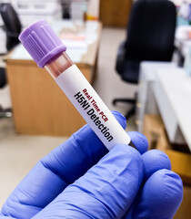 Blood Sample for RT PCR H5N1 test, avian influenza virus (AIV), avian flu or bird flu.