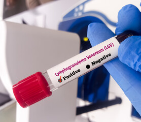 Blood sample for Lymphogranuloma Venereum (LGV) disease diagnosis test. LGV is a sexually...