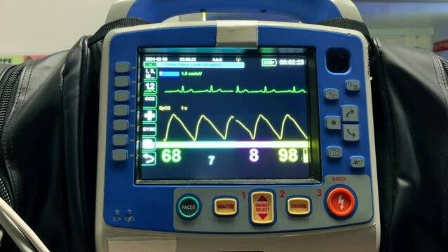 This is a close up of a cadiac monitor in use. It show a heartbeat, oxygen saturation and the corresponding numbers.
