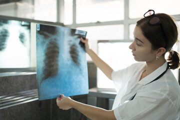 Female doctor checking anatomy and physiology x-ray film of patient in the hospital. Doctor...