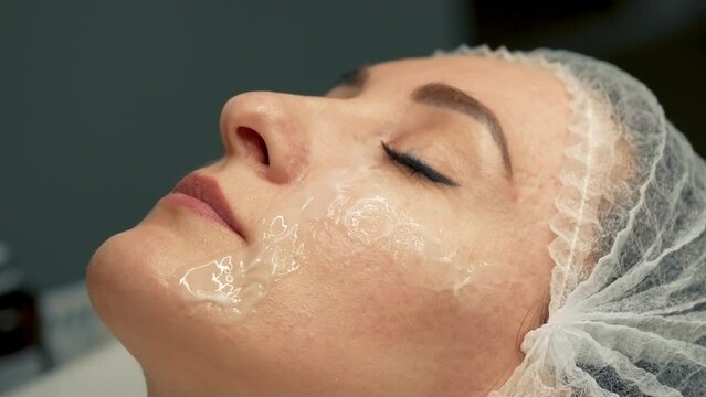 Woman skin treatment close up. Female patient lies on couch with anti-aging moisturizing cream applied to her face in cosmetic clinic. Cosmetic procedures, filler injections and rejuvenate for aging