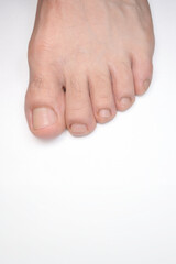 Close up of a person left foot toes with white background and space below for text