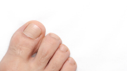 Closeup of a toe with white background and space for text on the right