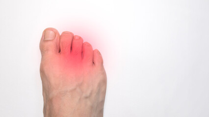 Right foot toes of a person with a red mark representing pain