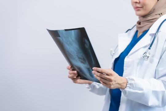 Asian Muslim doctor in hijab and scrubs headphones around her neck Stand confidently in the medical office, isolated on white background, holding x-ray film.