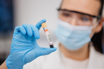 Laboratory assistant conducts an experiment in a scientific laboratory, studying a blood sample in...