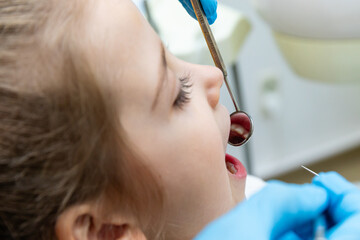 Close up dentist, doctor examines the oral cavity of a little girl, uses a mouth mirror, baby teeth close-up, the concept of pediatric dentistry, dental treatment.
