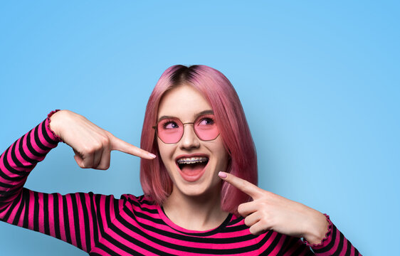 Dental dent care ad concept image - look up pink funny beautiful young woman in metal braces wear sunglasses, pointing white teeth smile. Isolated blue wall background. Positive optimistic.