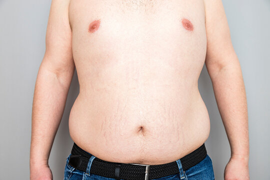 Overweight Caucasian Man's Belly, Health Concept