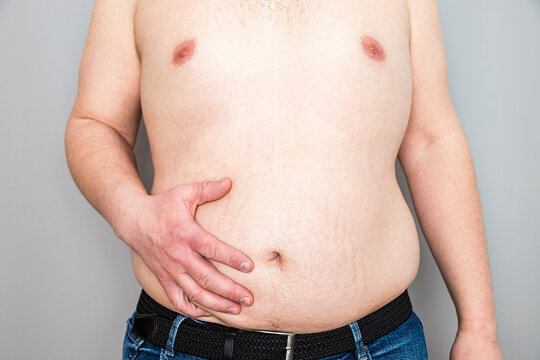 Man's Overweight Belly and Hands on Hips, Health Focus