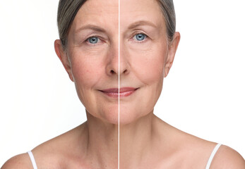 Aging skin changes. Collage with photos of mature woman before and after cosmetic procedure on...