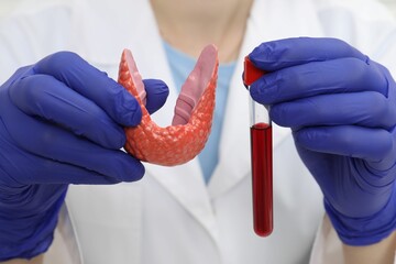 Endocrinologist showing thyroid gland model and blood sample in test tube, closeup