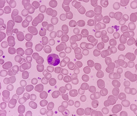 Photomicrograph of hematological slide showing RBC, WBC (Eosinophil) and platelet. Normal hemogram. CBC smear.