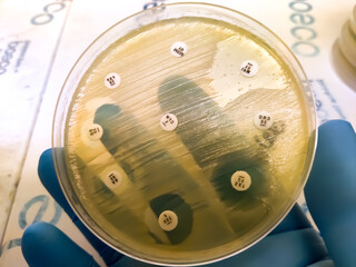 Antimicrobial susceptibility testing in petri dish. Microbiologist check Antibiotic resistance of bacteria