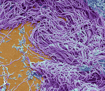 Faecal bacteria, SEM