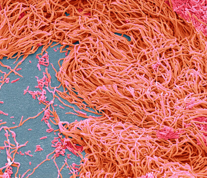 Faecal bacteria, SEM