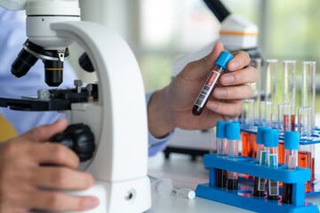 A medical technician is using a microscope to examine blood results on a patient.