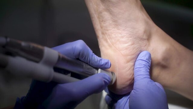 Podologist cleaning the heel of the foot in slow motion