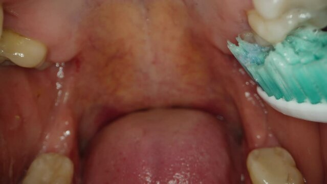 View Inside the Oral Cavity as Man Cleans Upper Teeth with a Toothbrush.