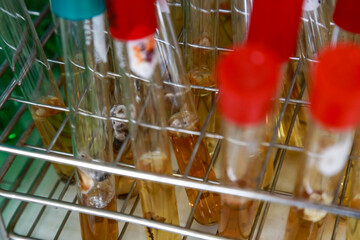 tube in rack