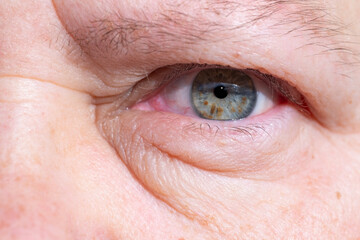 close-up mature woman's eye, revealing natural signs aging such wrinkles and puffiness under lower...