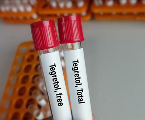 Blood sample for Tegretol(Carbamazepine) test that evaluates the blood levels of carbamazepine....