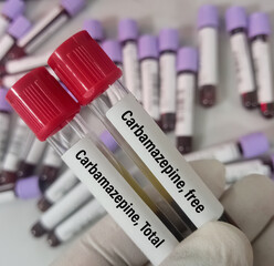 Blood sample for Carbamazepine(Tegretol) test that evaluates the blood levels of carbamazepine. Carbatrol, Epitol, Equetro, Tegretol-XR.