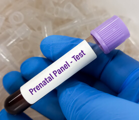 Blood sample for Prenatal panel test for pregnant women. Down syndrome. Disorder of the chromosomes.