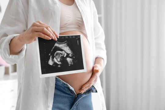Young pregnant woman with sonogram image in children's bedroom, closeup