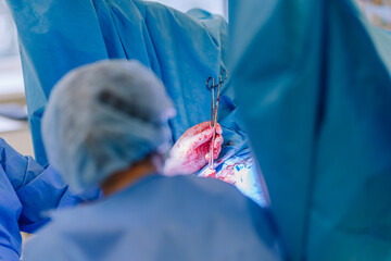 Valmiera, Latvia - March 20, 2024 - Surgeons performing surgery, with bloodied instruments and hands, in a bright operating room. - obrazy, fototapety, plakaty