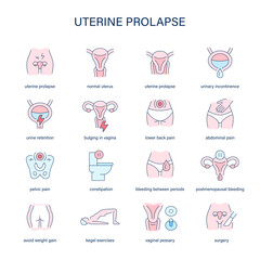 Uterine Prolapse symptoms, diagnostic and treatment vector icons. Medical icons.