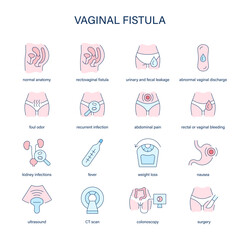 Vaginal Fistula symptoms, diagnostic and treatment vector icons. Medical icons.