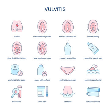 Vulvitis symptoms, diagnostic and treatment vector icons. Medical icons.
