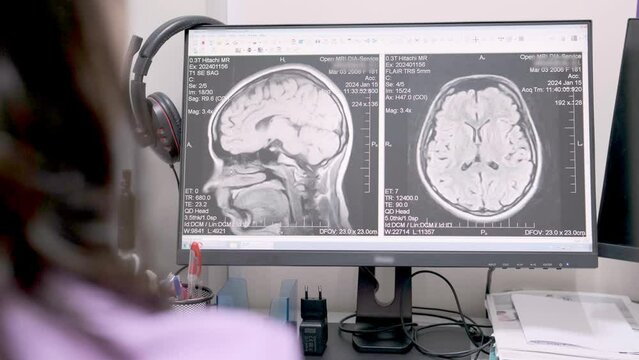 Hospital research laboratory: female medical scientist using a computer discussing the results. A professional neurologist analyzes a CT scan.