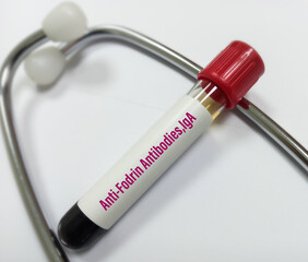 Blood sample for Anti Fodrin antibodies,IgA test. Sjogren SSA, SSB. Anti-Ro and Anti-La test. Anti...