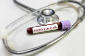 Blood sample for Enterovirus test to diagnosis of myocarditis. Enterovirus PCR test. Myocarditis disease blood test in doctor hand.
