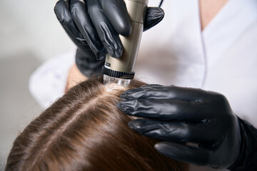 Close up of cosmetologist doing trichoscopy with trichoscope of woman hair