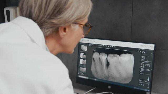 Dentist Examining Dental X-Ray on Monitor: Professional Diagnosis