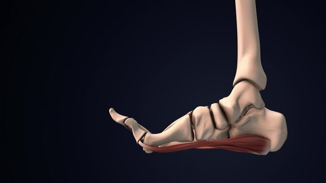Dysfunction of the plantar fascia