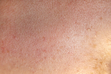 Texture of natural female skin close-up. Stock photo of the body in the best quality.