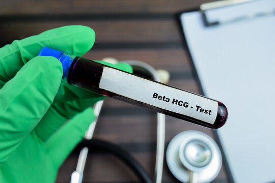 Beta HCG - Test with blood sample on wooden background. Healthcare or medical concept