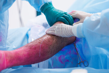 Doctor surgeon preparing patient leg before minimally invasive surgery, laparoscopic instrument for...