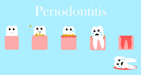 Periodontitis vector illustration. From a healthy tooth to its loss - obrazy, fototapety, plakaty