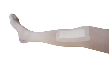 Human leg with bandaid and anti-embolic compression stocking. Conditions following anterior...