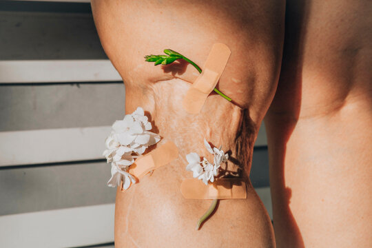 Flowers sticked with bandage on scar of woman's leg