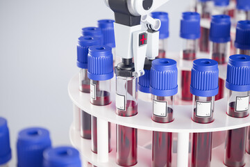 Advanced Automated Blood Analysis System Operating in Modern Laboratory - 767091364