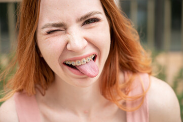 Young woman with braces on her teeth smiles and shows her tongue outdoors. 