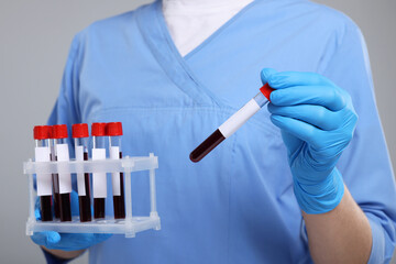 Laboratory testing. Doctor with blood samples in tubes on light grey background